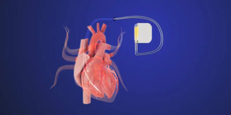 Ai Catheters In Heart Care Heart Catheters With AI