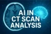 The Use of Artificial Intelligence in CT Scan Analysis - Post Thumbnail