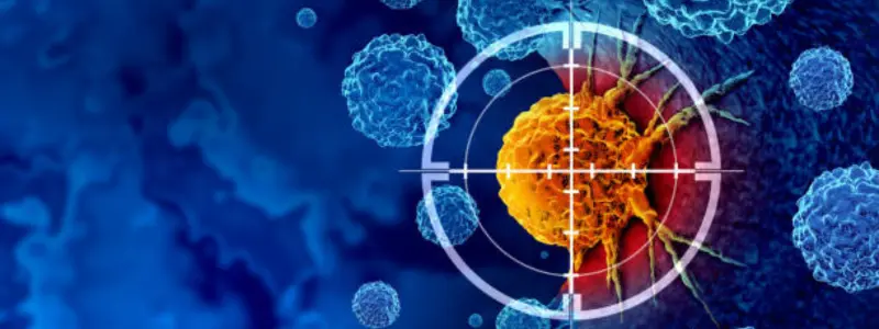 AI Spots Cancer Tumors