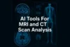 Top 5 AI Tools For Analysing MRI and CT Scans in 2025 - Post Thumbnail
