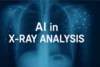 AI in X-Ray Analysis: How Smart Tech is Changing Medical Imaging - Post Thumbnail