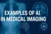 Real Life Examples of AI in Medical Imaging - Post Thumbnail