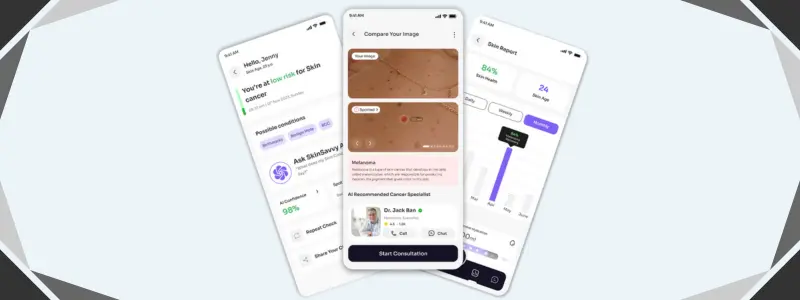 Skinvision Health Ai App Skinvision AI App in Healthcare